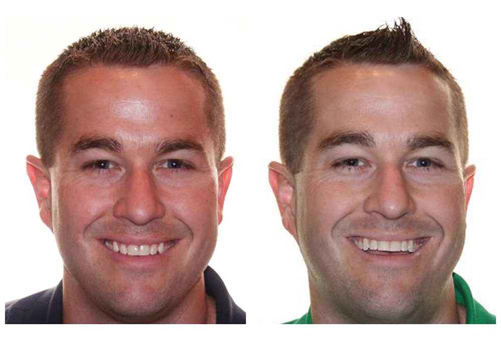 Commerce City Dentist