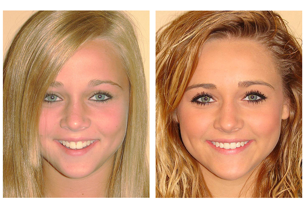 Commerce City Dentist