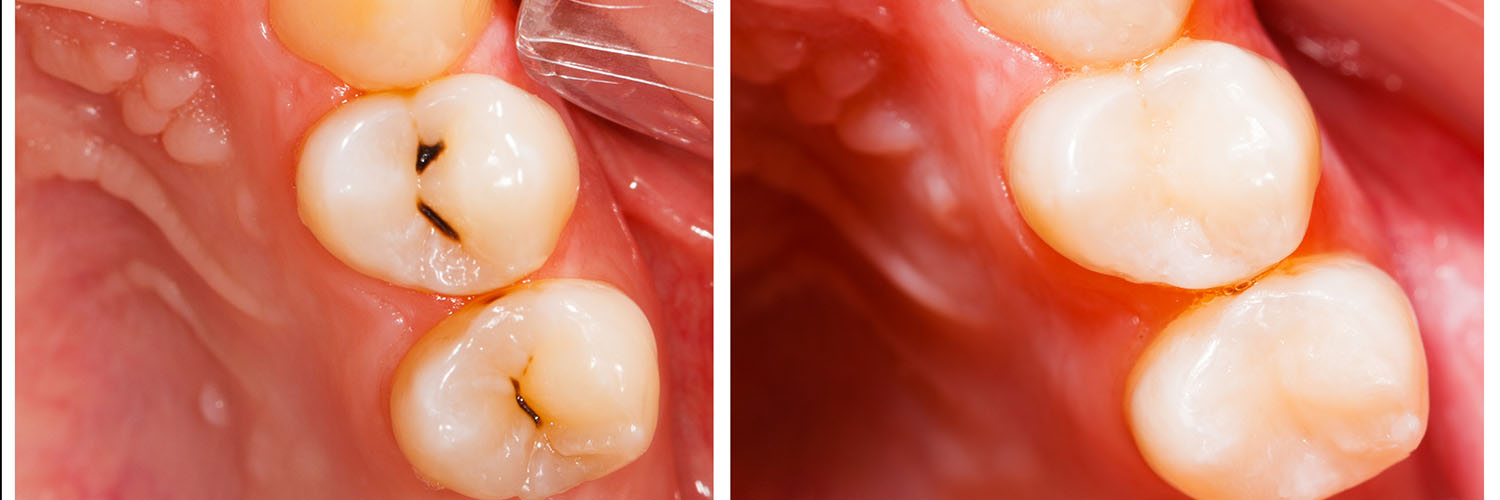 Commerce City Dentist
